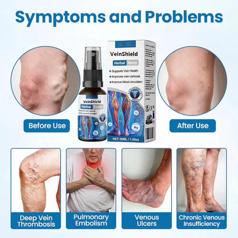 đ„ Az utolsĂł 3 Ăłra: Nagyobb kedvezmĂ©ny a mĂĄsodik termĂ©kre! đ„ VeinShield Herbal Spray - a felhasznĂĄlĂłk 94%-a 1-2 hĂ©ten belĂŒl lĂĄthatĂł eredmĂ©nyeket tapasztal!