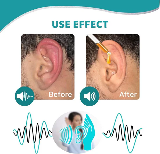 ✅Juxek™ Fülápolás – Növényi alapú formula | ✅FDA által jóváhagyott és megbízható